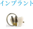 インプラント